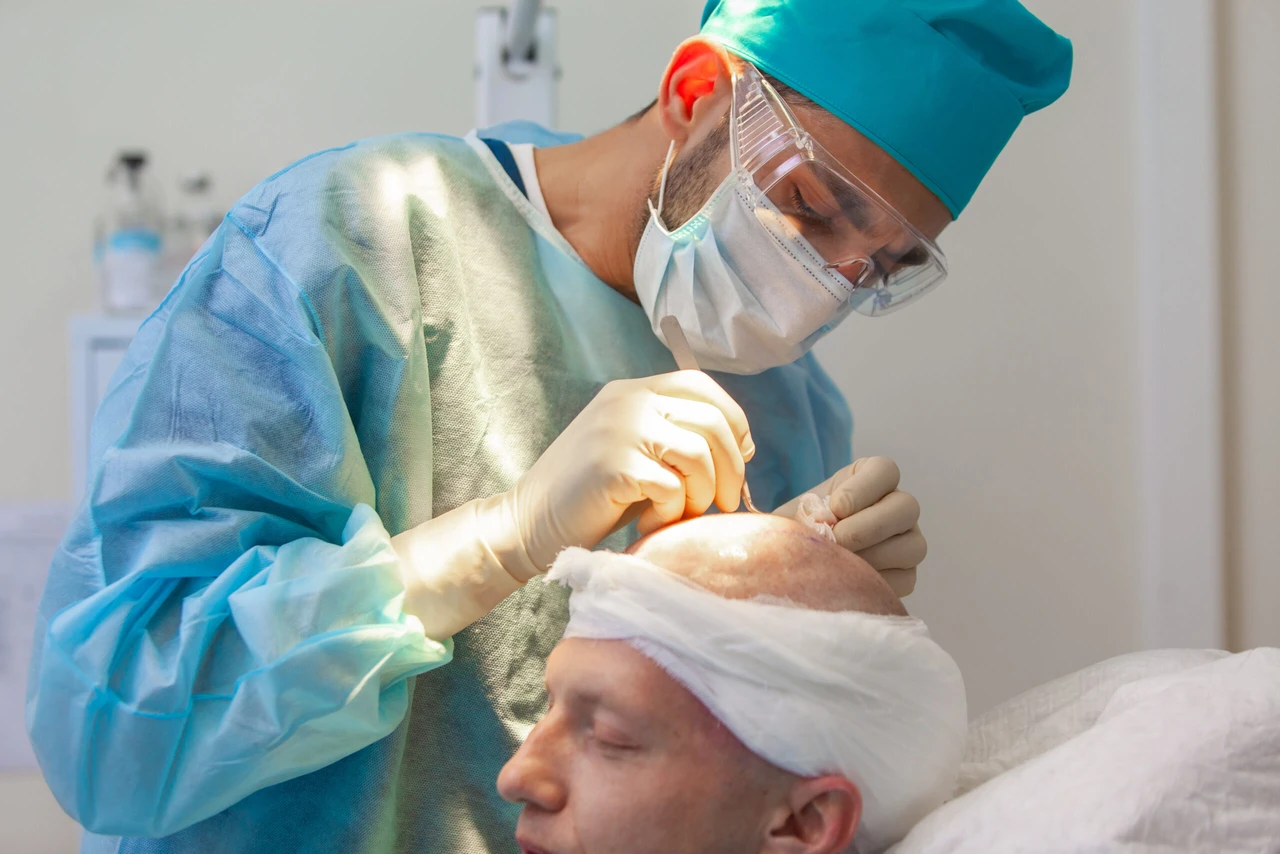 A surgeon wearing protective gear performs a hair transplant on a patient with a bandaged head in a medical facility in Istanbul, Türkiye.