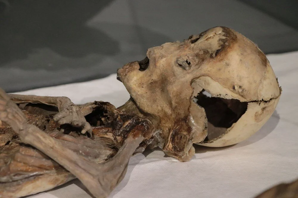 Ancient Anatolia's mummies: 97 years later, clues reveal strangulation, Christian beliefs