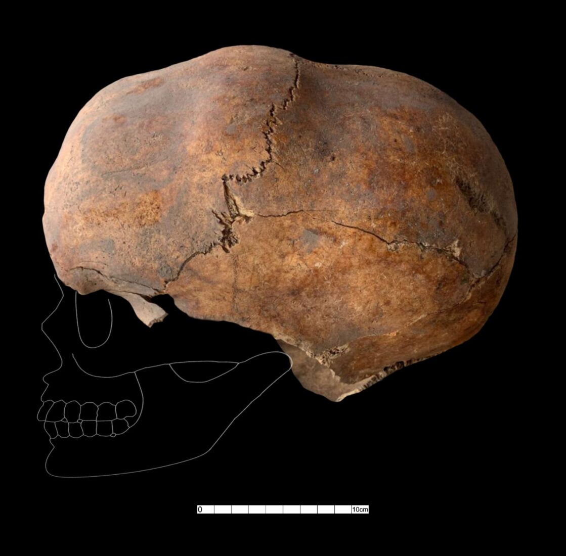 6,000-year-old shaped skull, 820-bead necklace discovered at Türkiye's Yassihoyuk