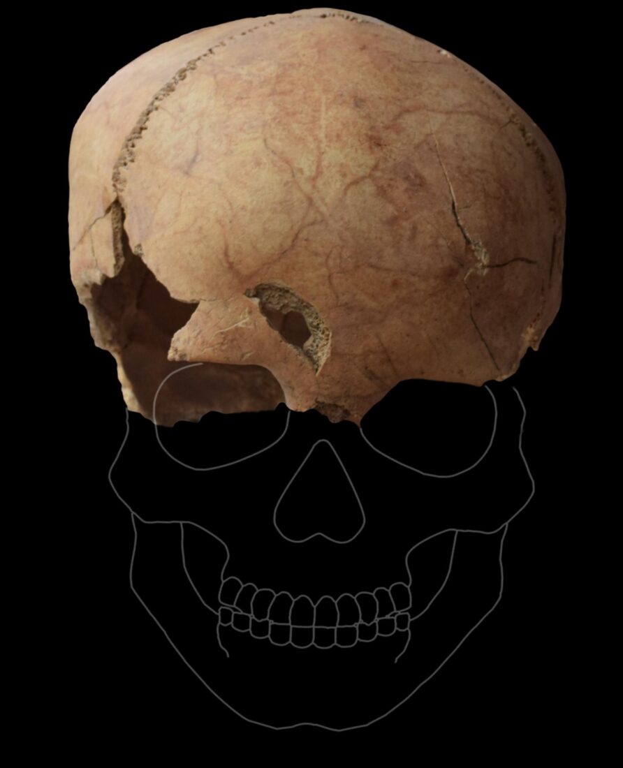 6,000-year-old shaped skull, 820-bead necklace discovered at Türkiye's Yassihoyuk