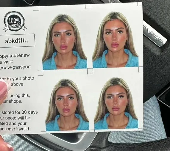 Türkiye's cosmetic surgery boom causes passport control chaos