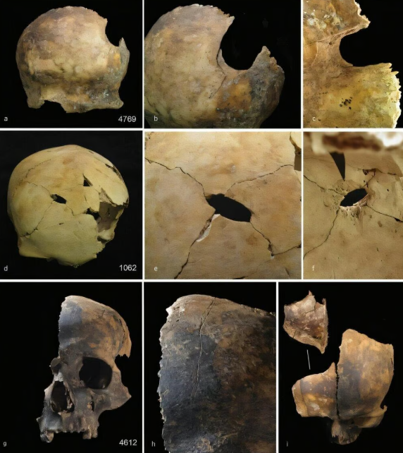 Shocking discovery: 4,000-year-old cannibalism evidence found in Bronze Age massacre in UK