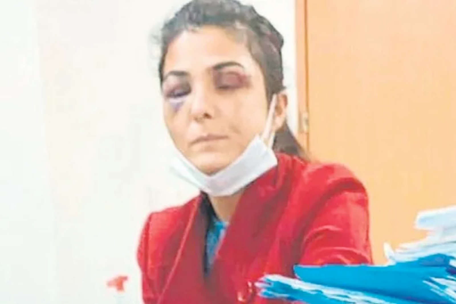 Turkish woman who was a victim of domestic abuse, Melek Ipek, with bruised eyes during her first court hearing