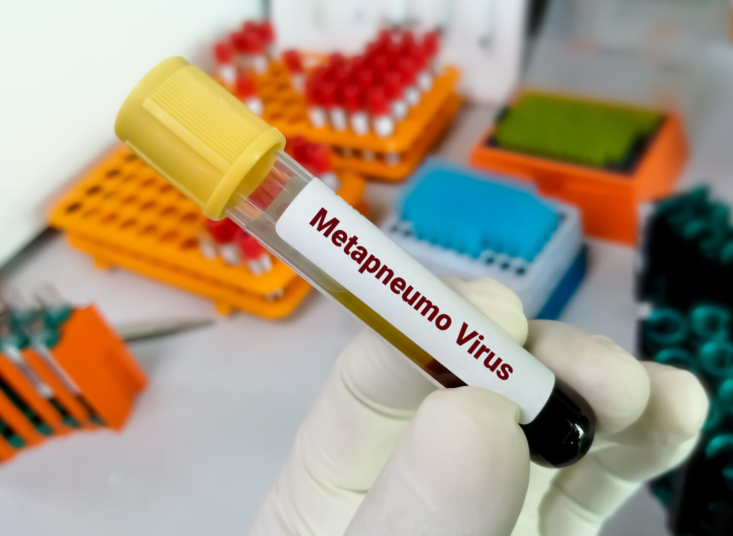 human metapneumovirus (HMPV)