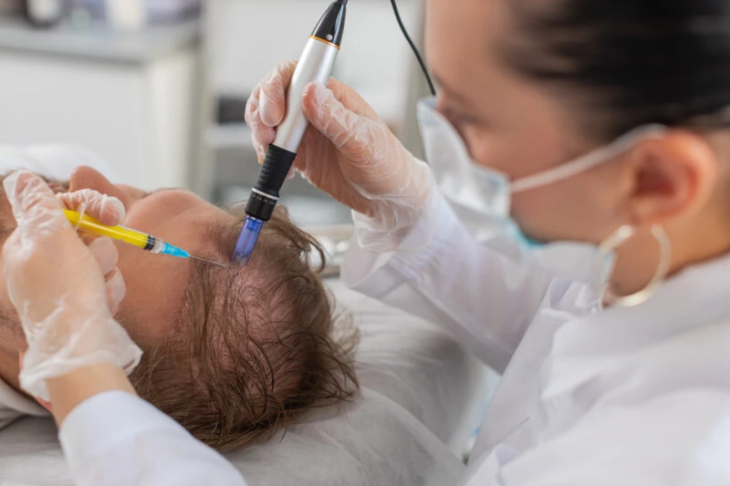 A specialist in a white coat and gloves administers PRP therapy to a patient's scalp using a microneedling device and syringe in a clinic in Türkiye.