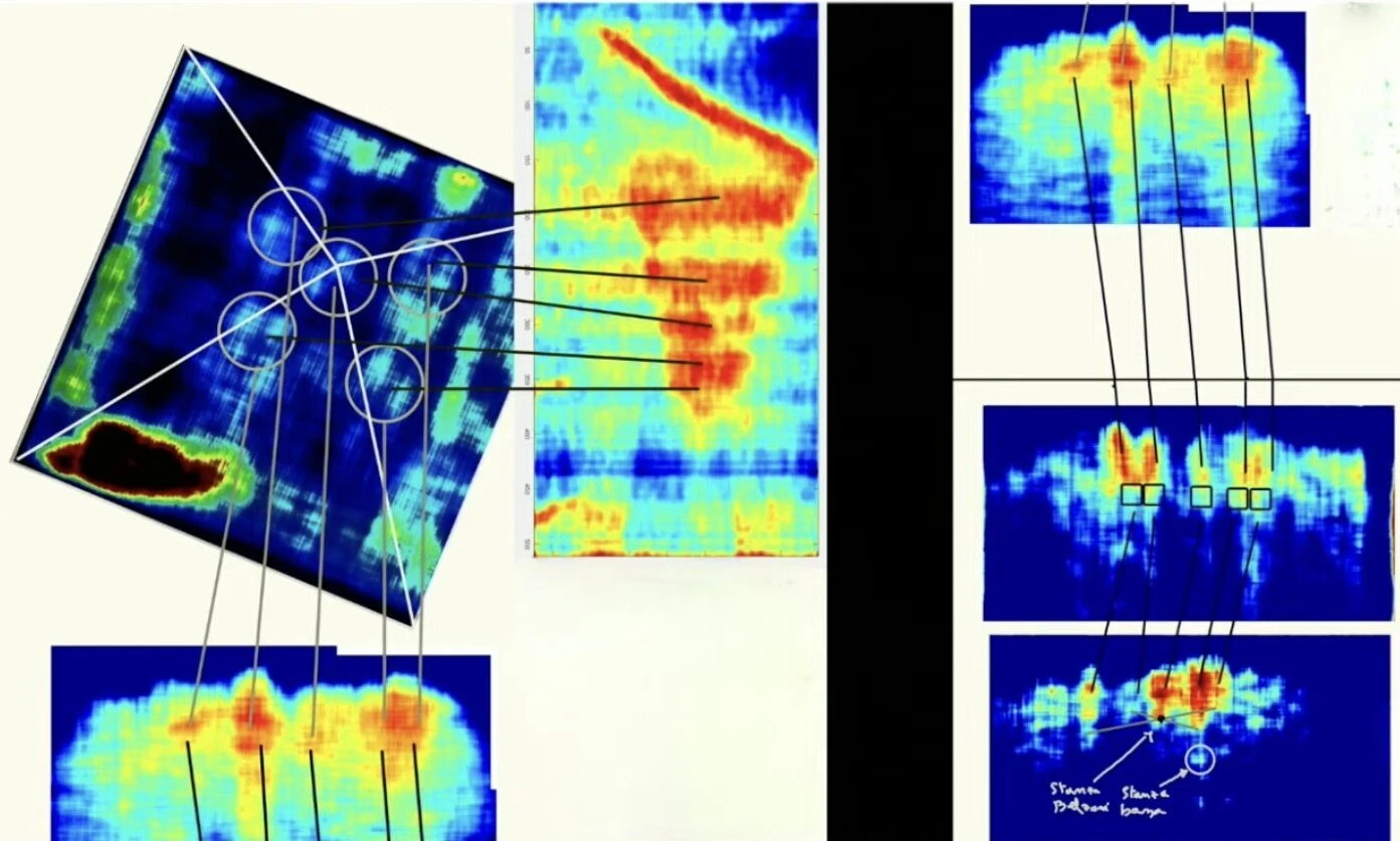 Tomographic image