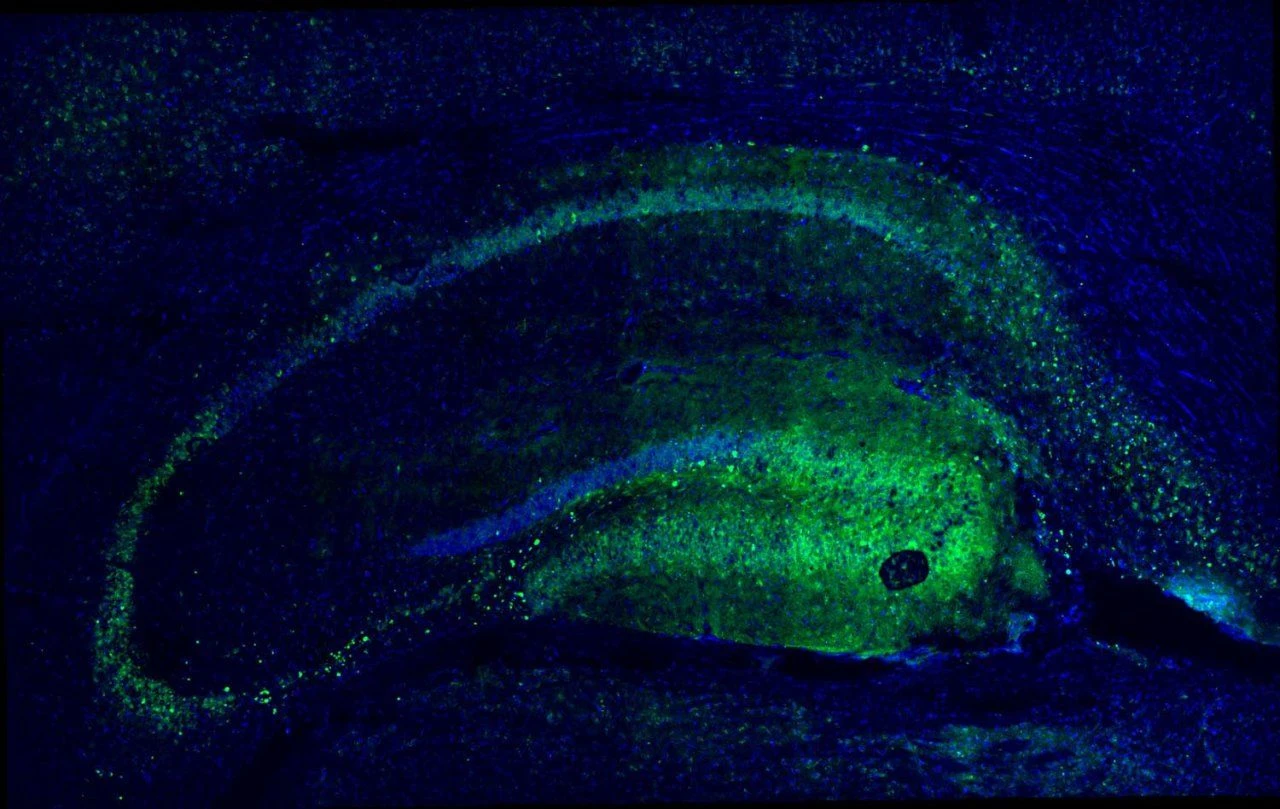 Green fluorescent oligodendrocytes in the mouse hippocampus under a microscope.