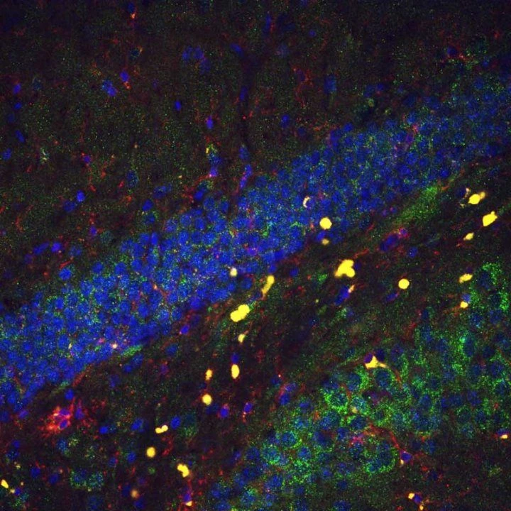 Yellow-marked oligodendrocytes in mouse hippocampus during PLP1 gene study.