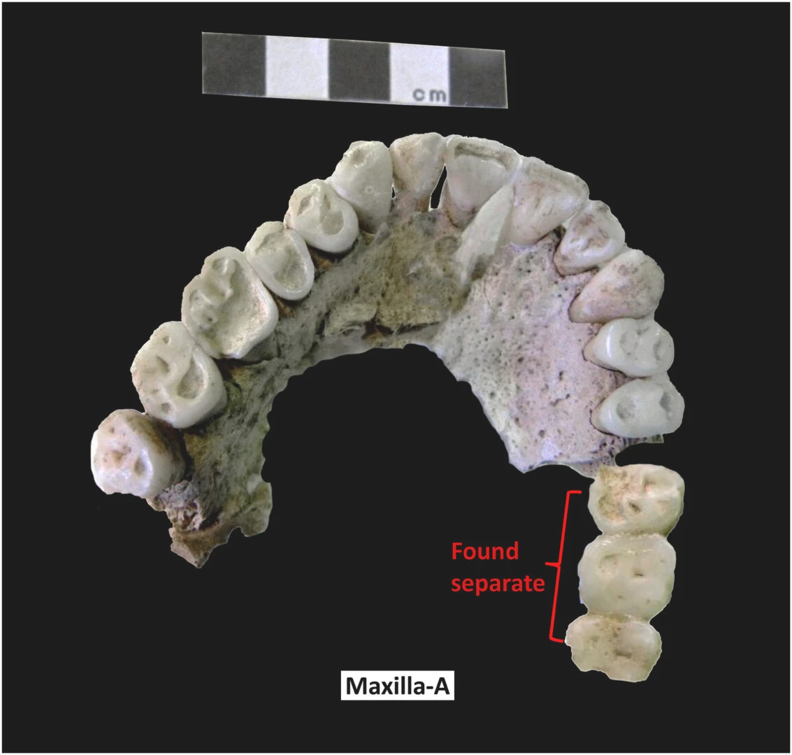 Maxilla-A (inferior view) from the same individual as Mandible-A